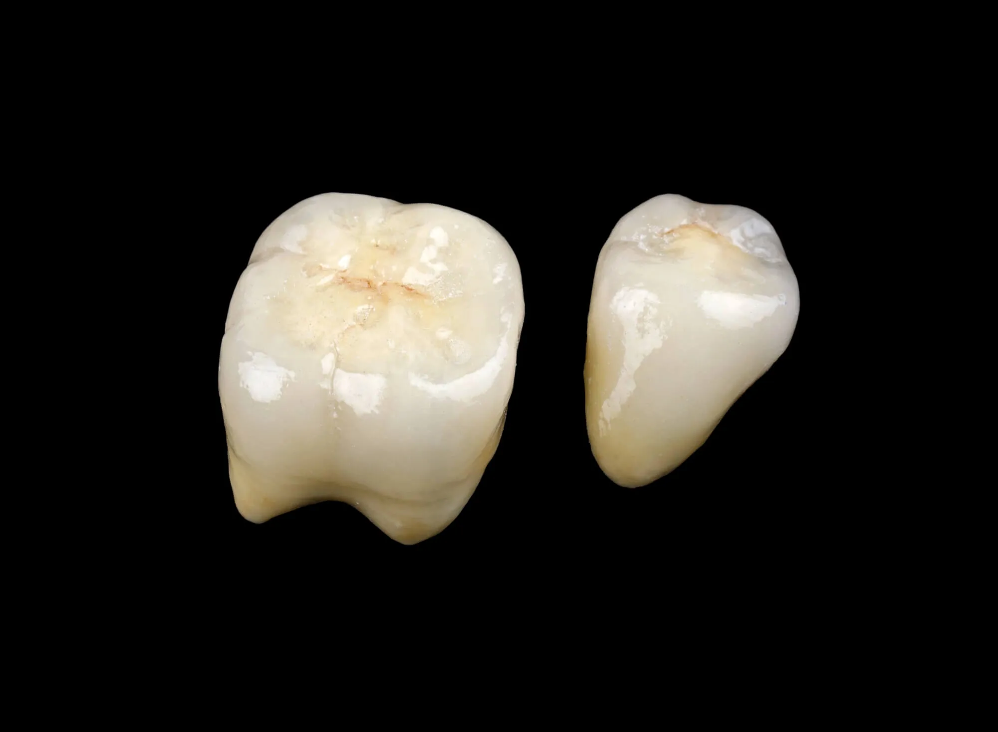 crowns boca raton