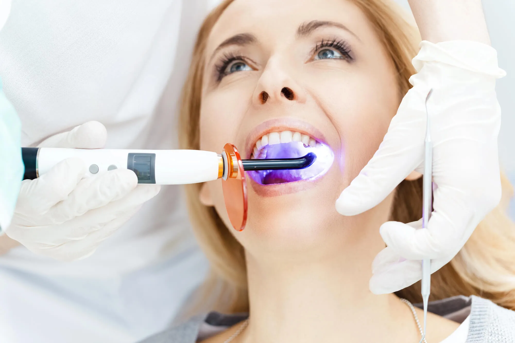 professional teeth whitening boca raton
