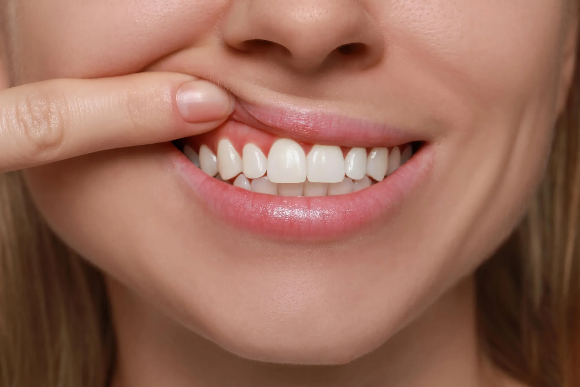 patient-with-inflamed-gums-needs-to-visit-a-periodontist-boca-raton